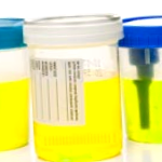 Urine