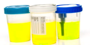 Urine
